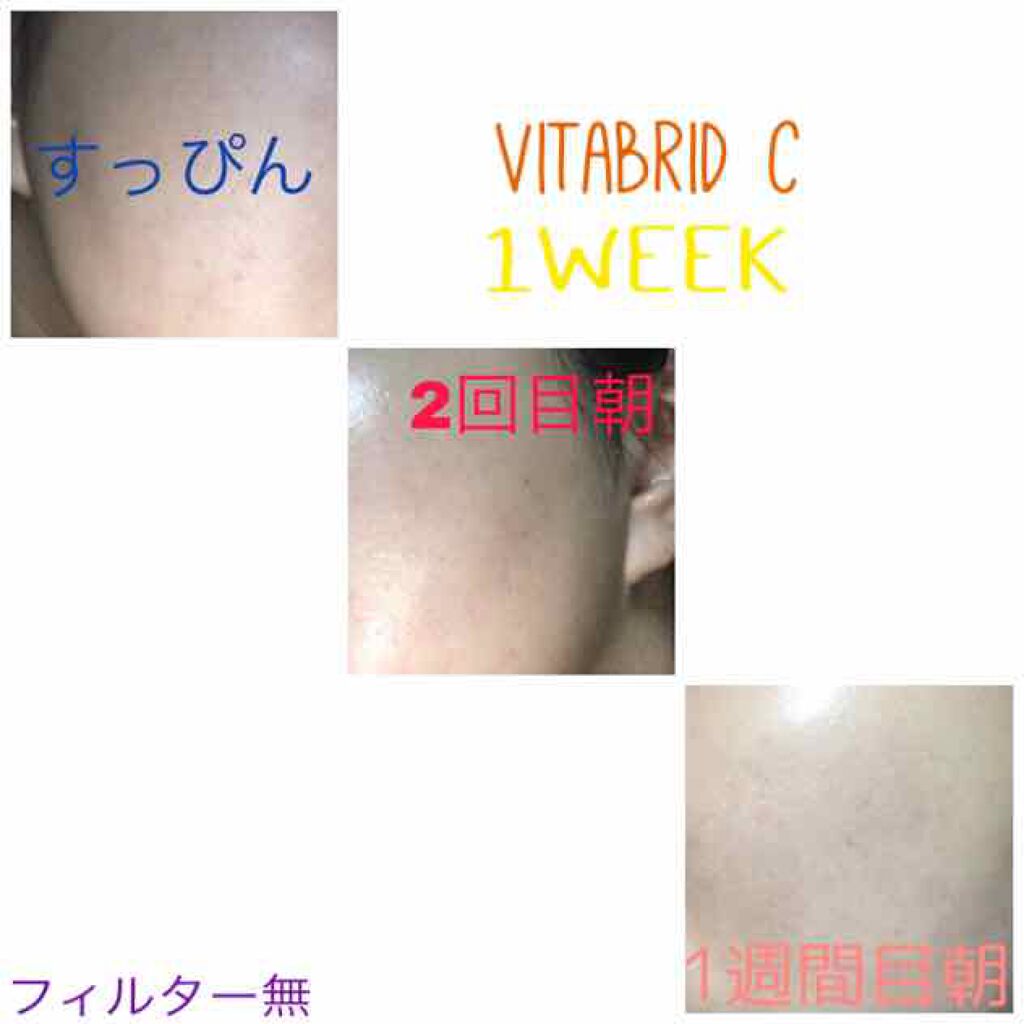 美白化粧水 VC/ちふれ/化粧水を使ったクチコミ(2枚目)