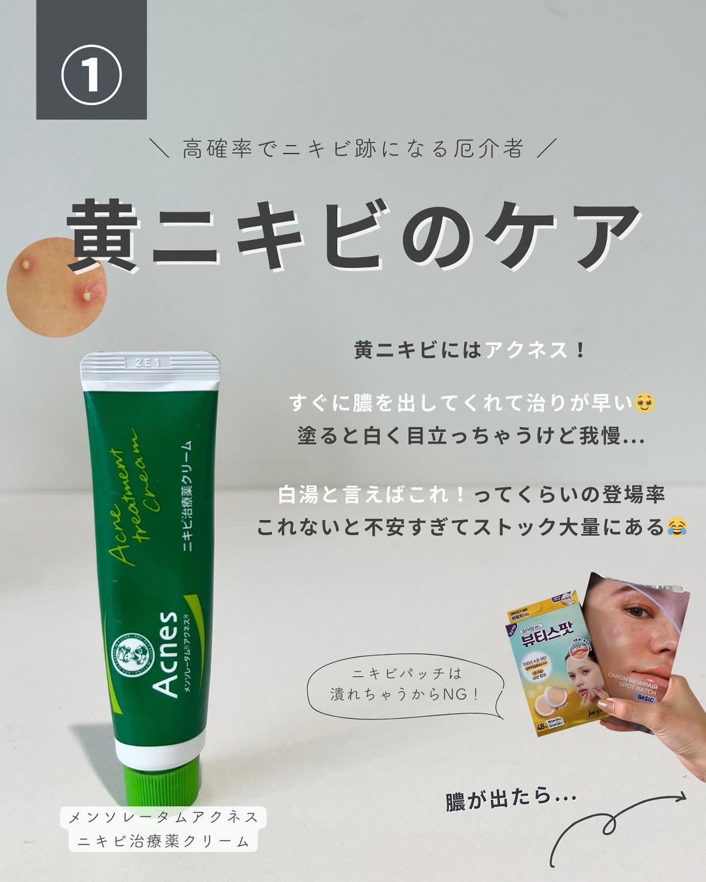 白湯(サユ) | ニキビと戦うOL🤍 on LIPS 「これ見ればOK!ニキビ改善の教科書📕ニキビって一括りにされる..」(3枚目)