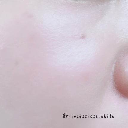 ピンクティーツリーカバークッション/APLIN/クッションファンデーションを使ったクチコミ(5枚目)