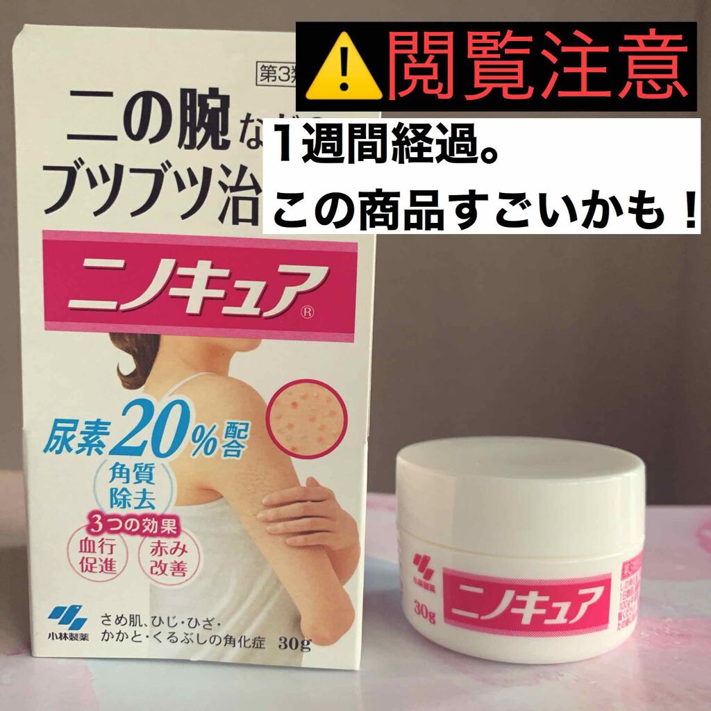 ニノキュア(医薬品)/ニノキュア/その他を使ったクチコミ(1枚目)