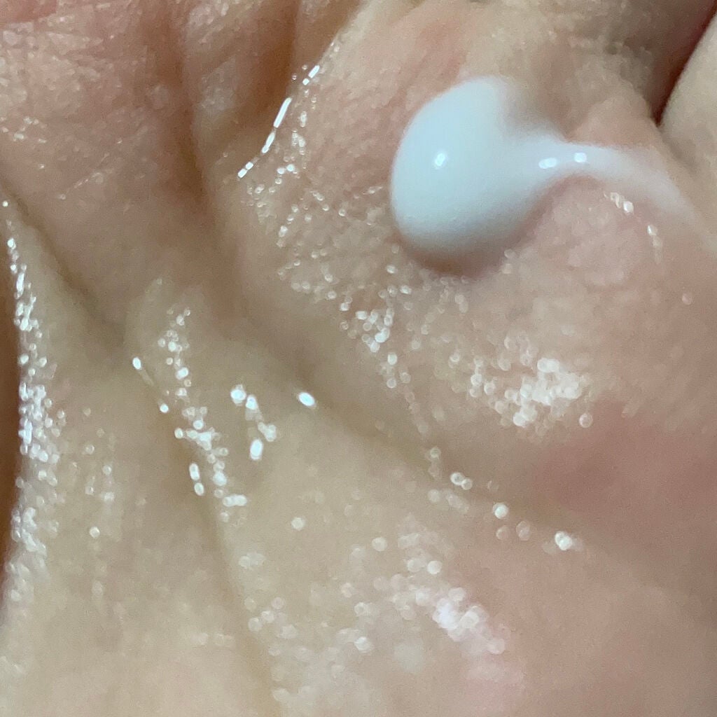 アクネケア セット N/d プログラム/トライアルキットを使ったクチコミ(2枚目)