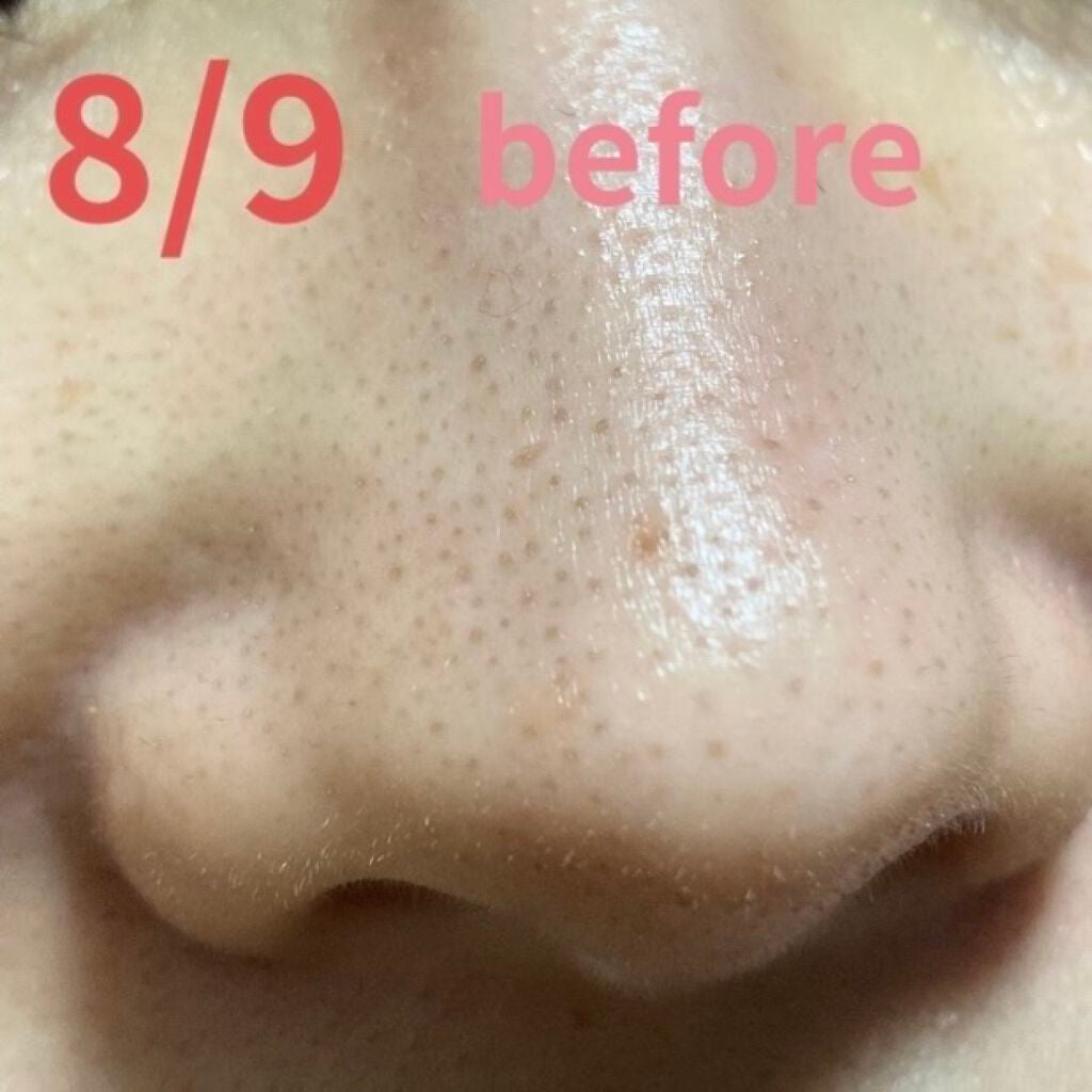 デュオ ザ クレンジングバーム ブラック/DUO/クレンジングバームを使ったクチコミ(3枚目)