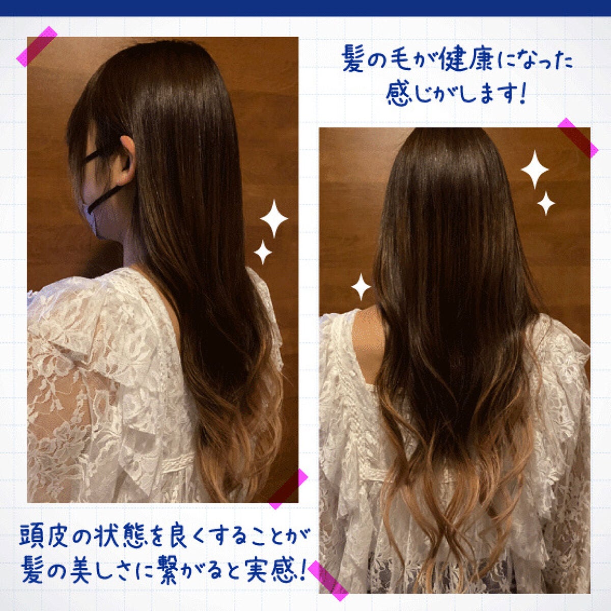 薬用頭皮ケアトニックD/日本ライフ製薬/頭皮ローションを使ったクチコミ(5枚目)
