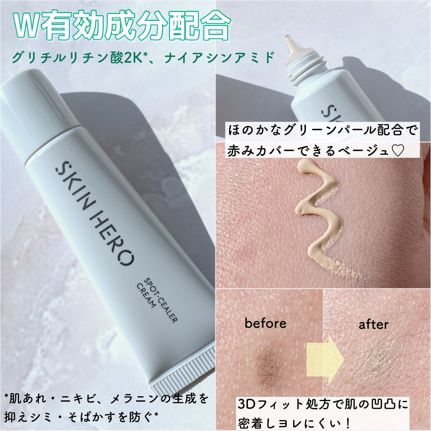 薬用スポットシーラークリーム/スキンヒーロー/クリームコンシーラーを使ったクチコミ(2枚目)