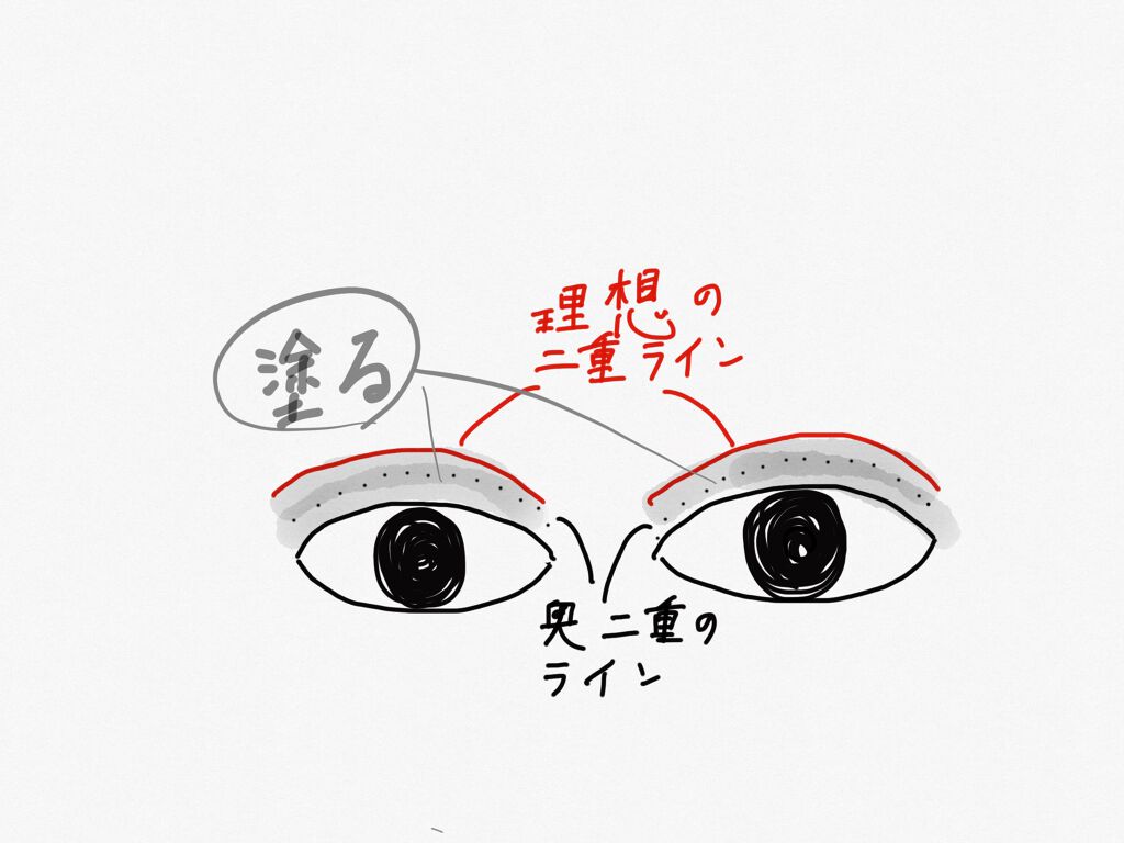 アイビューティー フィクサー WP/アストレア ヴィルゴ/二重まぶた用アイテムを使ったクチコミ（1枚目）