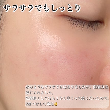 AHA·BHA·PHA 30デイズミラクルトナー/SOME BY MI/化粧水を使ったクチコミ(4枚目)