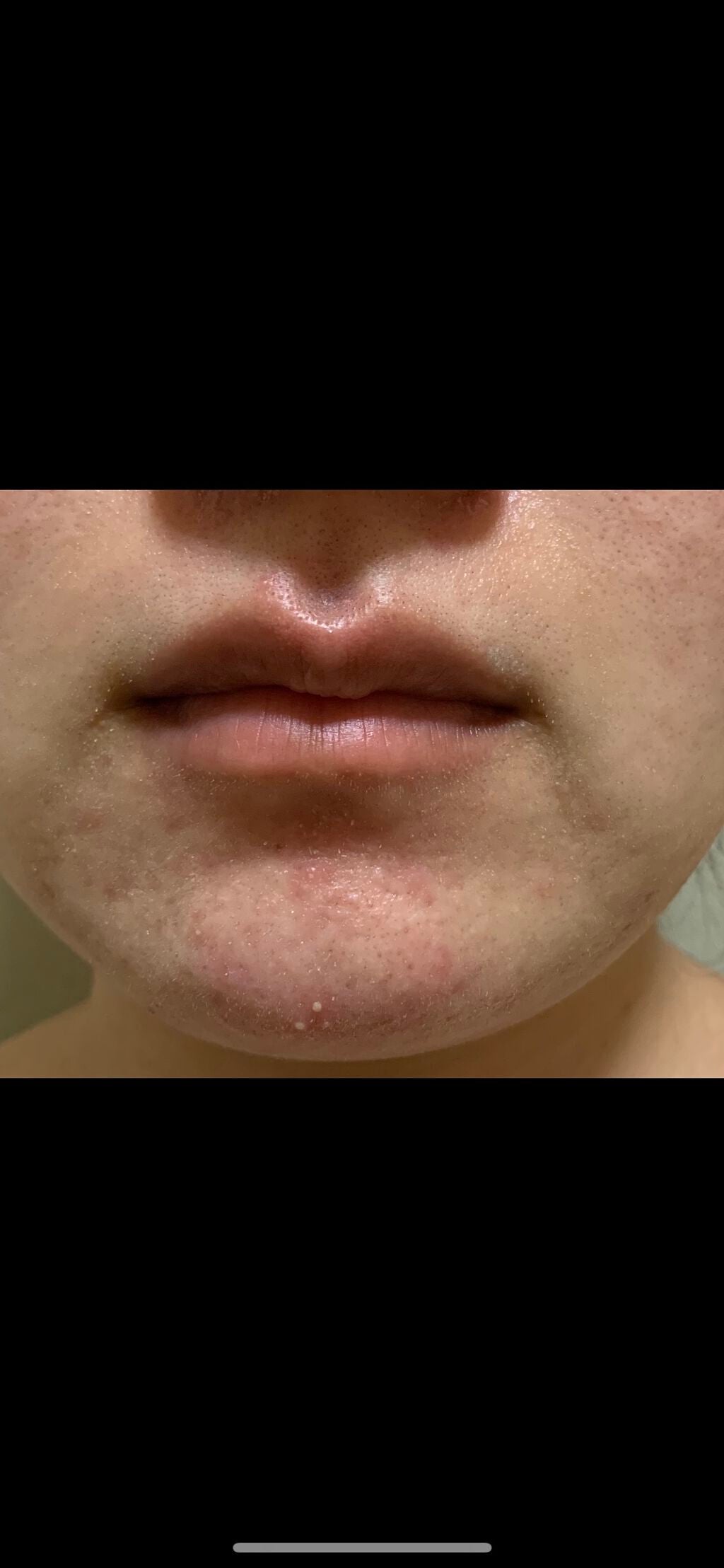 カステラ on LIPS 「⚠️2枚目以降汚いです⚠️肌の調子が良いので記録!🐄スキンケア..」(3枚目)