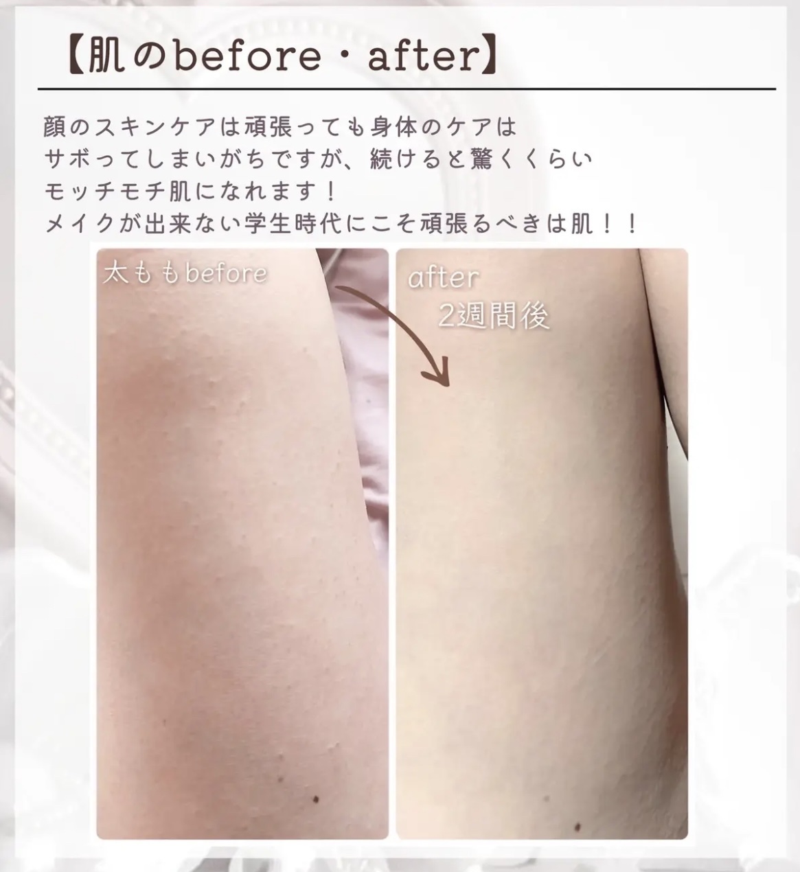 ハトムギ化粧水(ナチュリエ スキンコンディショナー R )/ナチュリエ/化粧水を使ったクチコミ（3枚目）