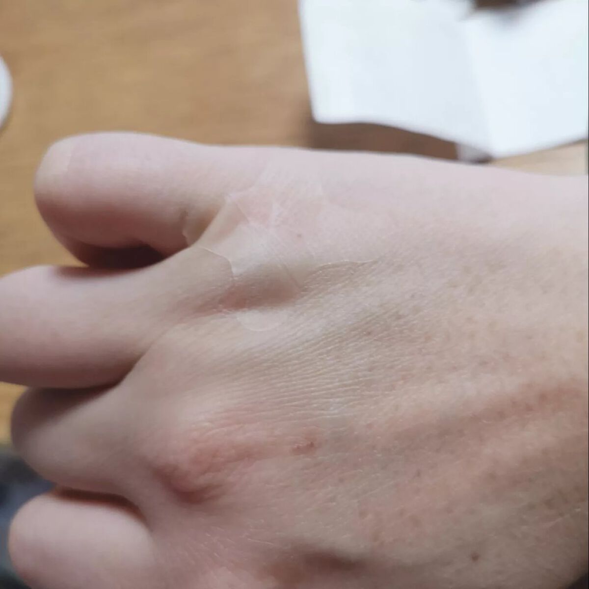 キズクイックfit/東洋化学/その他を使ったクチコミ(4枚目)