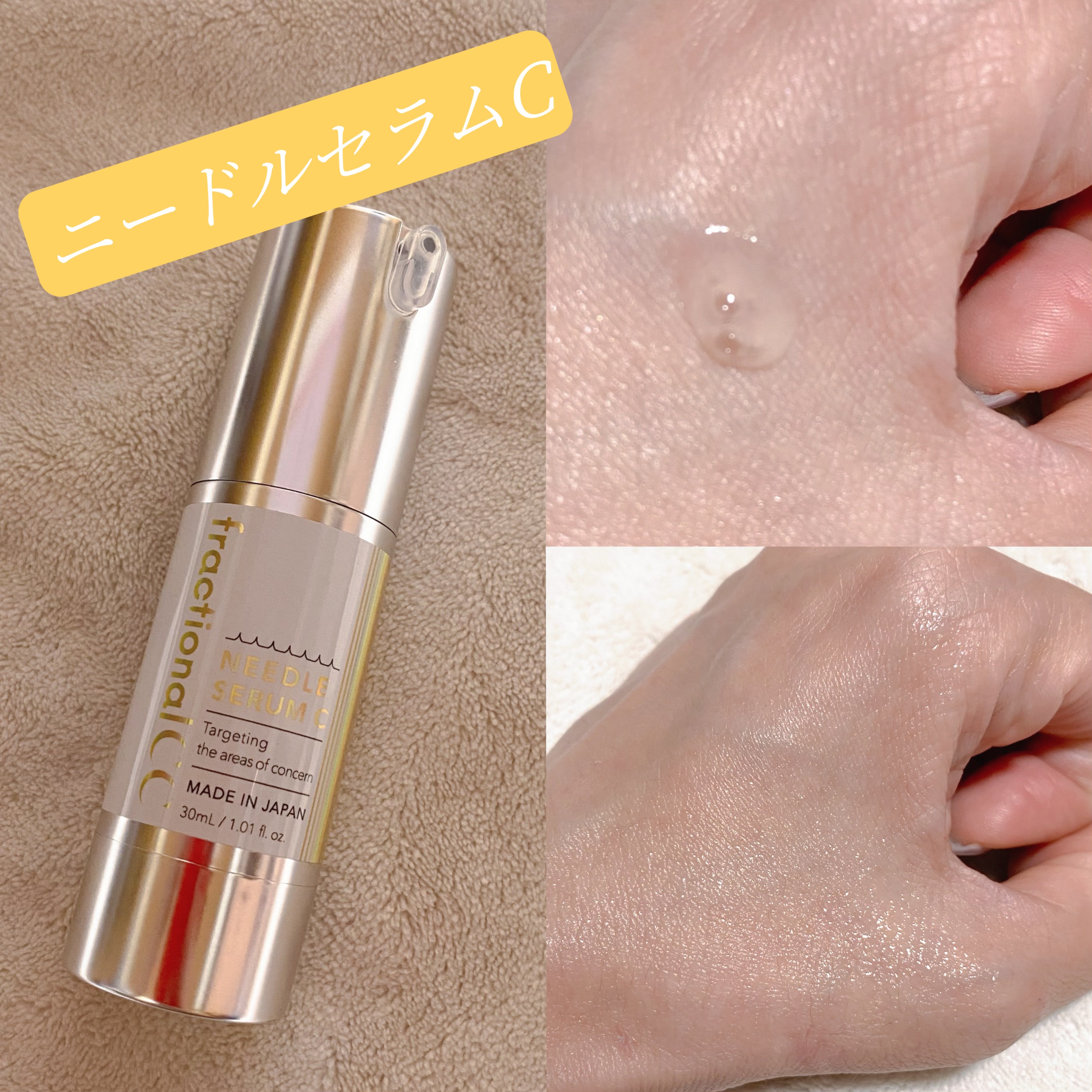 fractionalCC ニードルセラムC/fractionalCC/美容液を使ったクチコミ（2枚目）