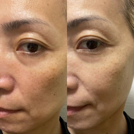 プロフィニッシュリキッド/インテグレート/リキッドファンデーションを使ったクチコミ(5枚目)