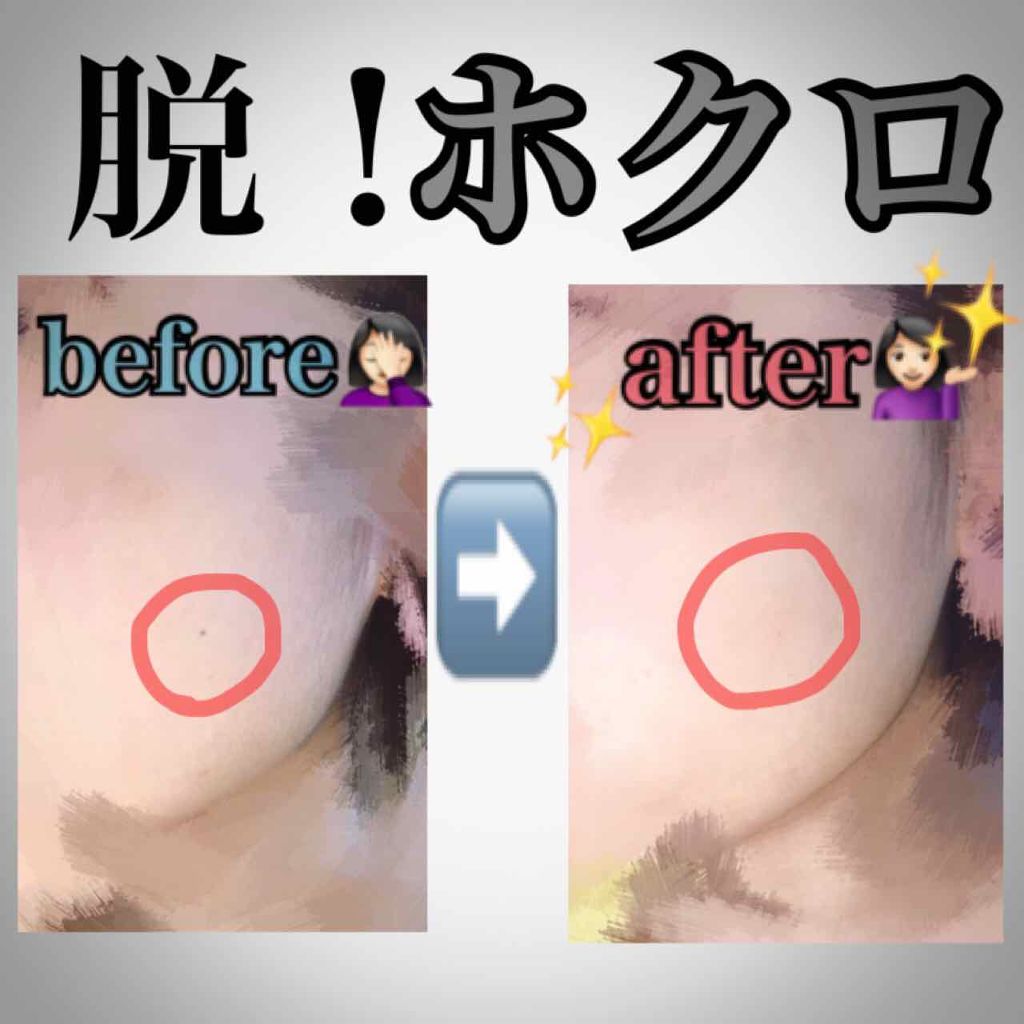 スポッツカバー ファウンデイション/SHISEIDO/クリームコンシーラーを使ったクチコミ（1枚目）