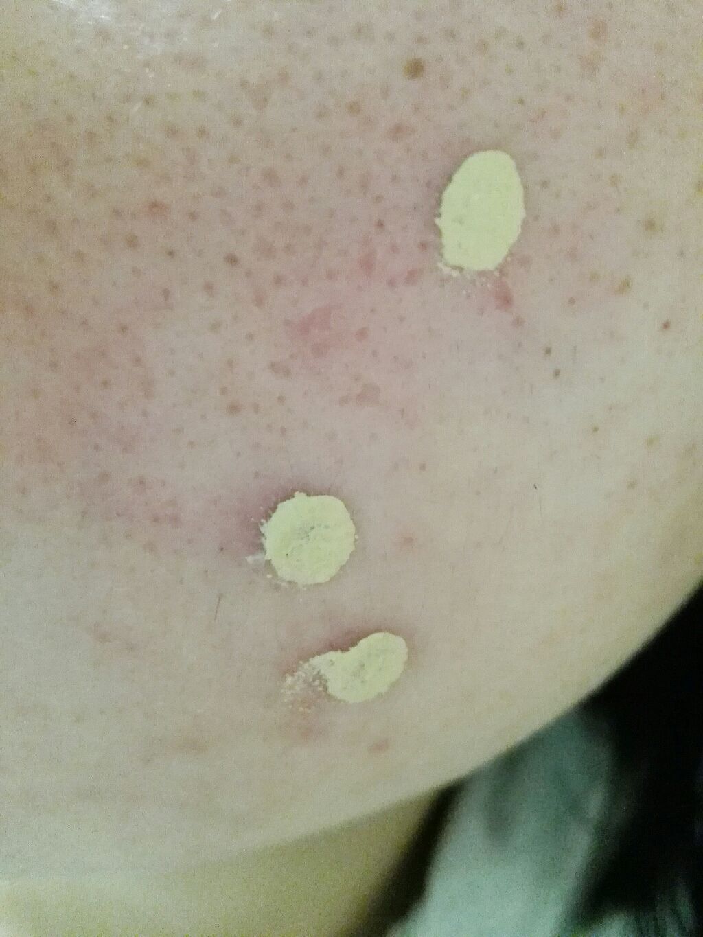 カラーコンシーラー/セラフォア/リキッドコンシーラーを使ったクチコミ(3枚目)