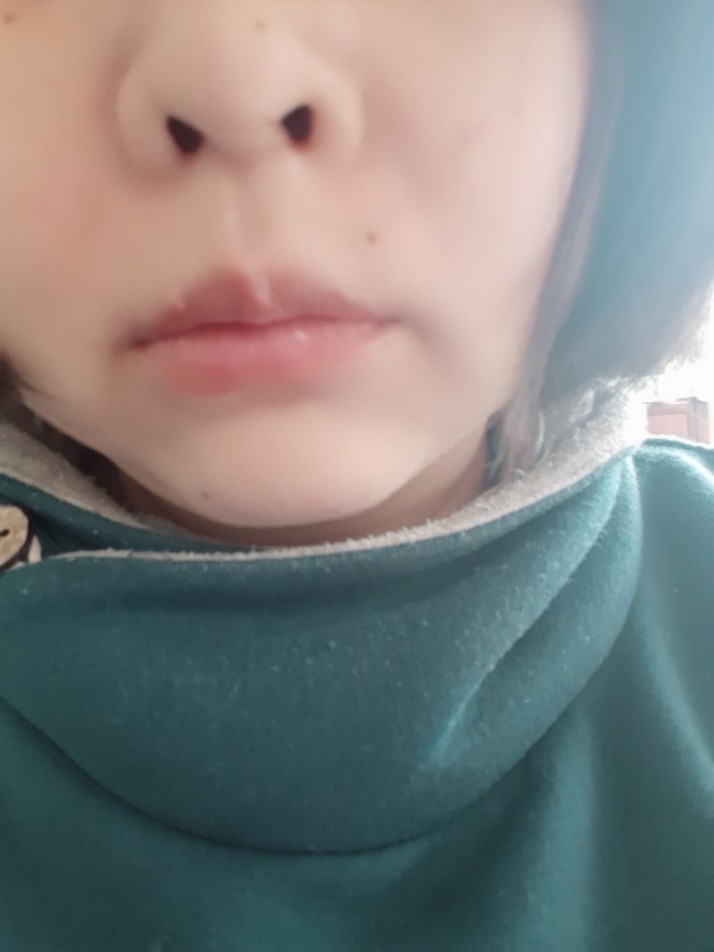 ハニーラスター r/ROAlív/リップグロスを使ったクチコミ(2枚目)