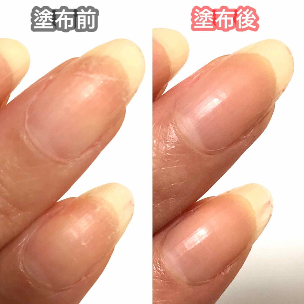 キューティクルオイル/ネイルホリック/ネイルオイル・トリートメントを使ったクチコミ（2枚目）