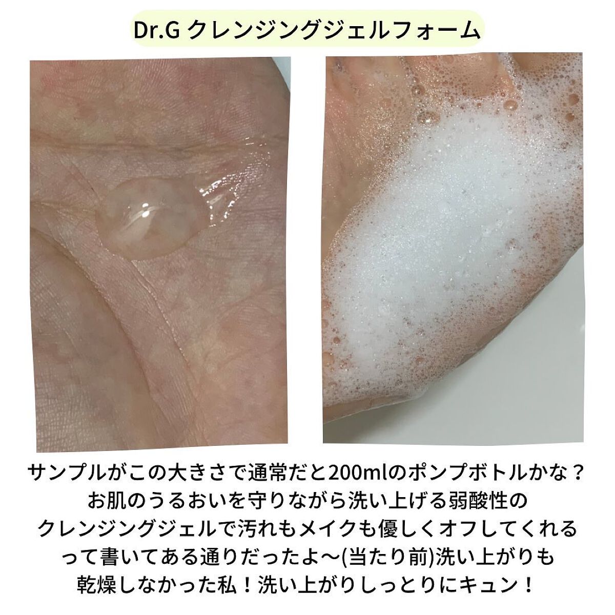 レッドB・Cスムージングクリーム/Dr.G/フェイスクリームを使ったクチコミ（2枚目）