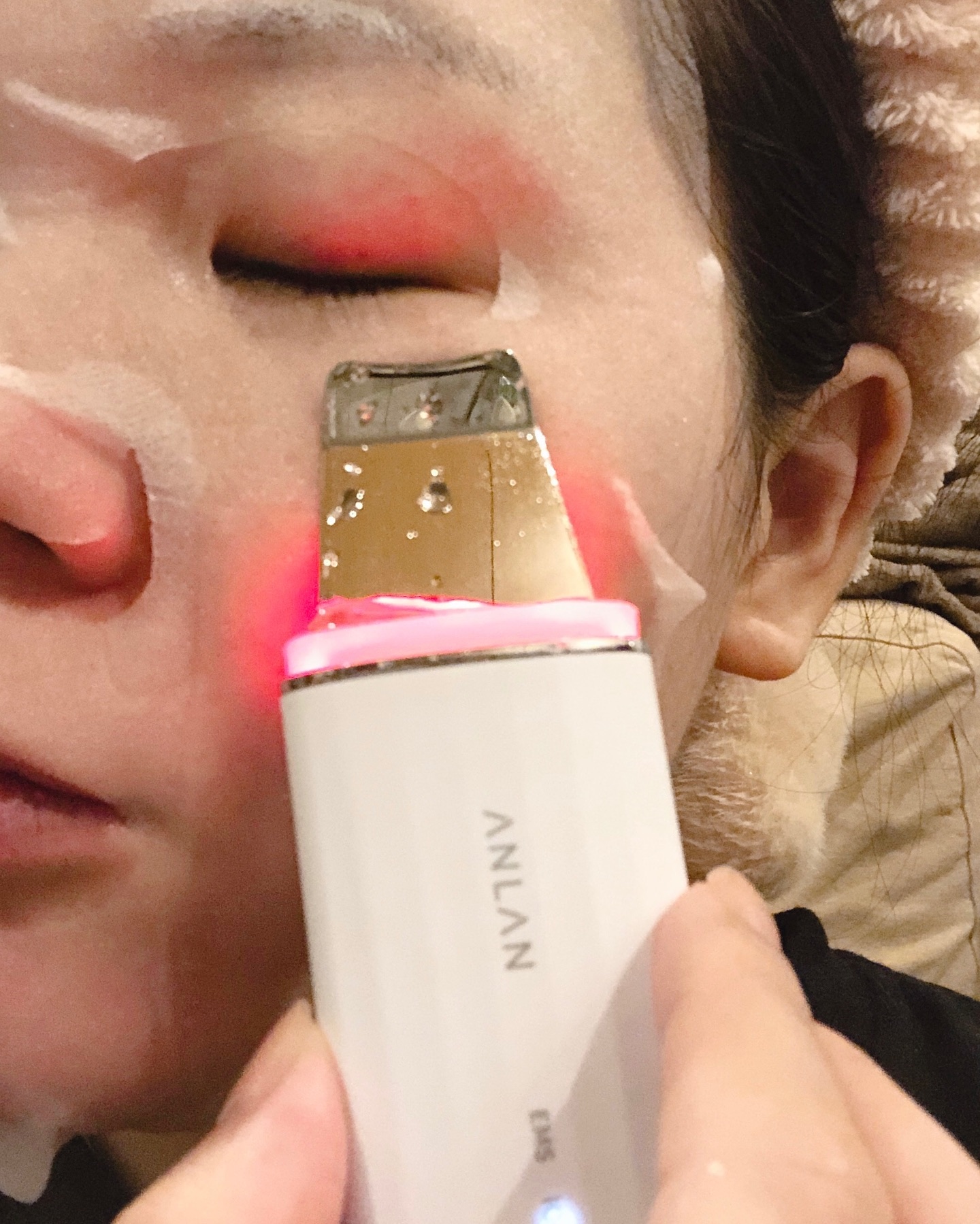 ロイヤル ウォーターピーリング IPX7完全防水/ANLAN/美顔器・マッサージを使ったクチコミ（3枚目）