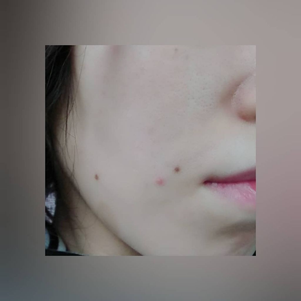 トラブルリペア リキッド/アルージェ/美容液を使ったクチコミ(3枚目)