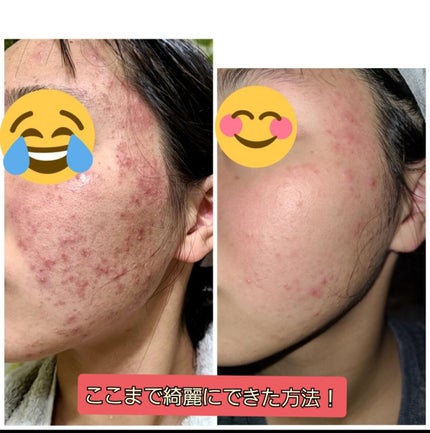 CICA ケアトナー/BEAUSTA/化粧水を使ったクチコミ(1枚目)