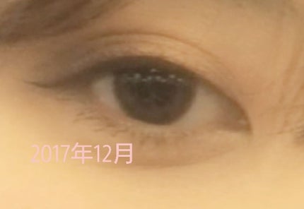 リッドキララ/北の快適工房/アイケア・アイクリームを使ったクチコミ(3枚目)