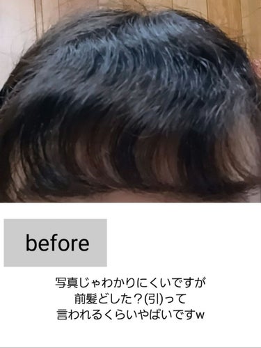 ヘアーオイル【スムース＆シャイニー】/ellips/ヘアオイルを使ったクチコミ（2枚目）