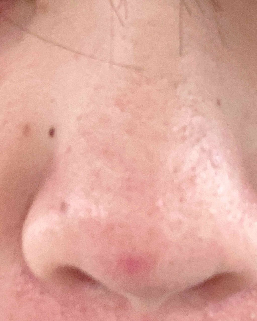 かなえ on LIPS 「あぁ。ダメだあ。。。みなさんに言われたこと全てやって見ましたが..」(1枚目)