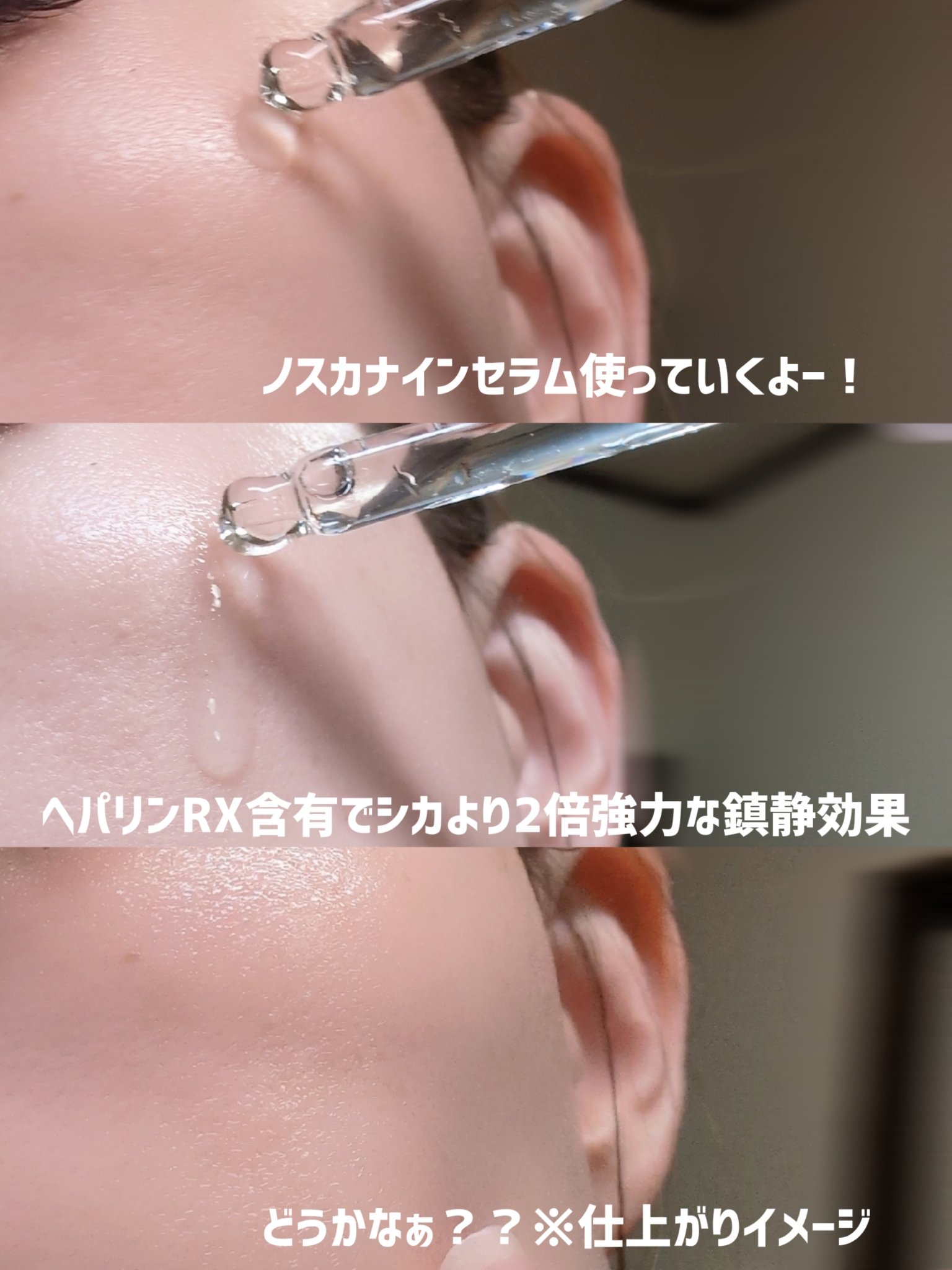 ノスカナイン トラブル セラム/FATION/美容液を使ったクチコミ（3枚目）