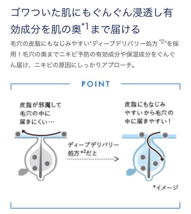 薬用 クリアローション M(しっとりタイプ)/オルビス/化粧水を使ったクチコミ（3枚目）