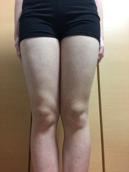 hosizoraakari on LIPS 「『11日間でどのくらい垢抜けれるか』6日目..」(5枚目)