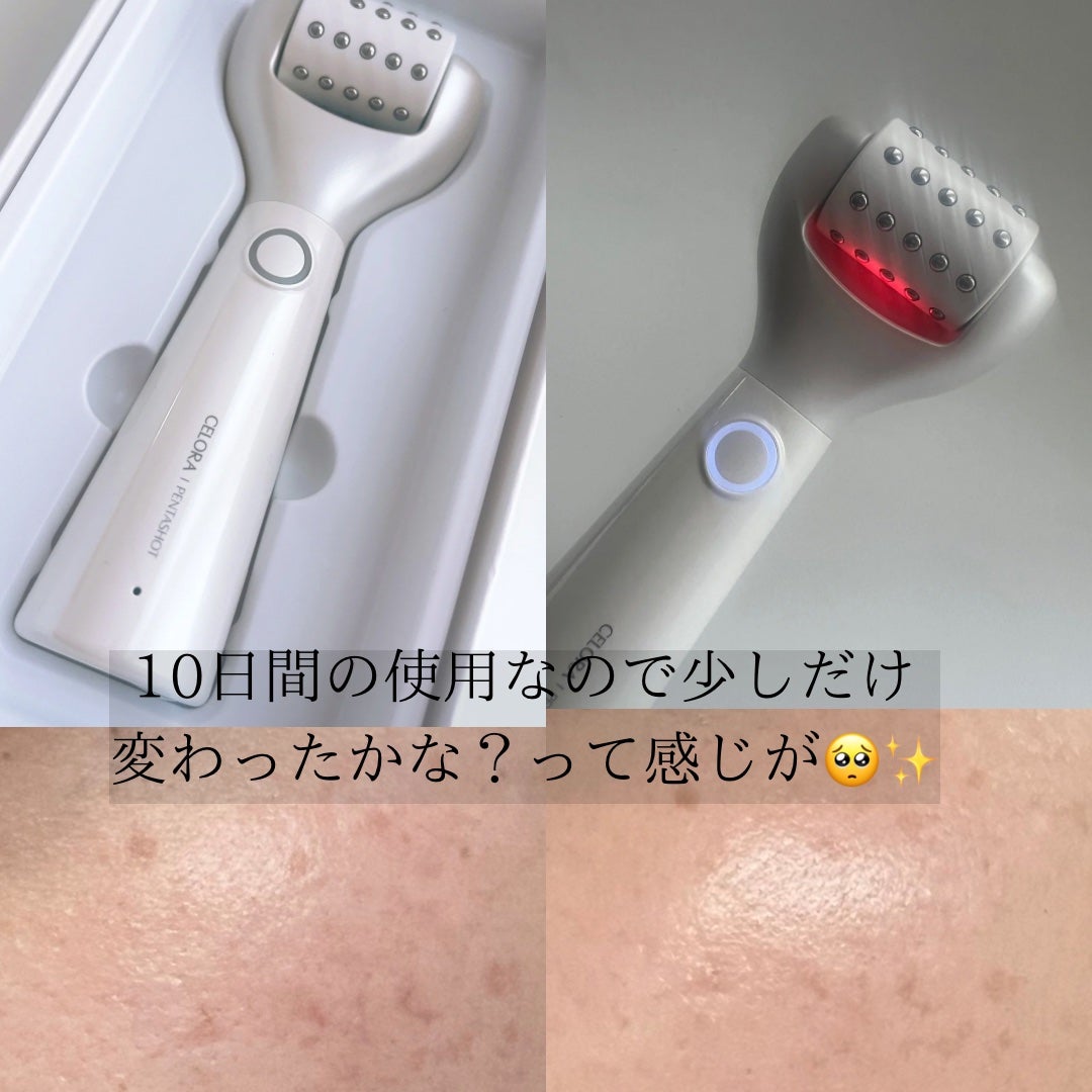 ポテンションポアタイトニングブーストセラム|CELORABY他、1 ポテンションポアタイトニングブーストセラム|CELORABY他、1