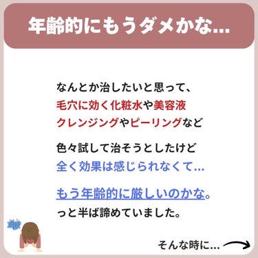 あなたの肌に合ったスキンケア💐コーくん on LIPS 「【2.7万人が効果を実感】毛穴の開きが3日消える裏技🔥..あな..」（4枚目）