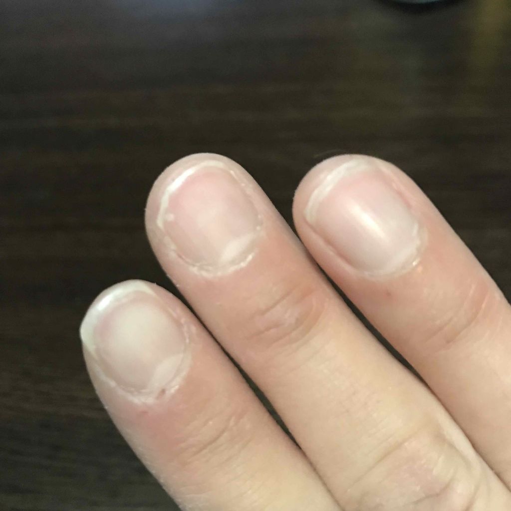 エテュセ クイックケアコート/ettusais/ネイルオイル・トリートメントを使ったクチコミ（2枚目）