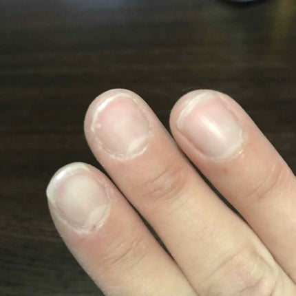 エテュセ クイックケアコート/ettusais/ネイルオイル・トリートメントを使ったクチコミ(2枚目)