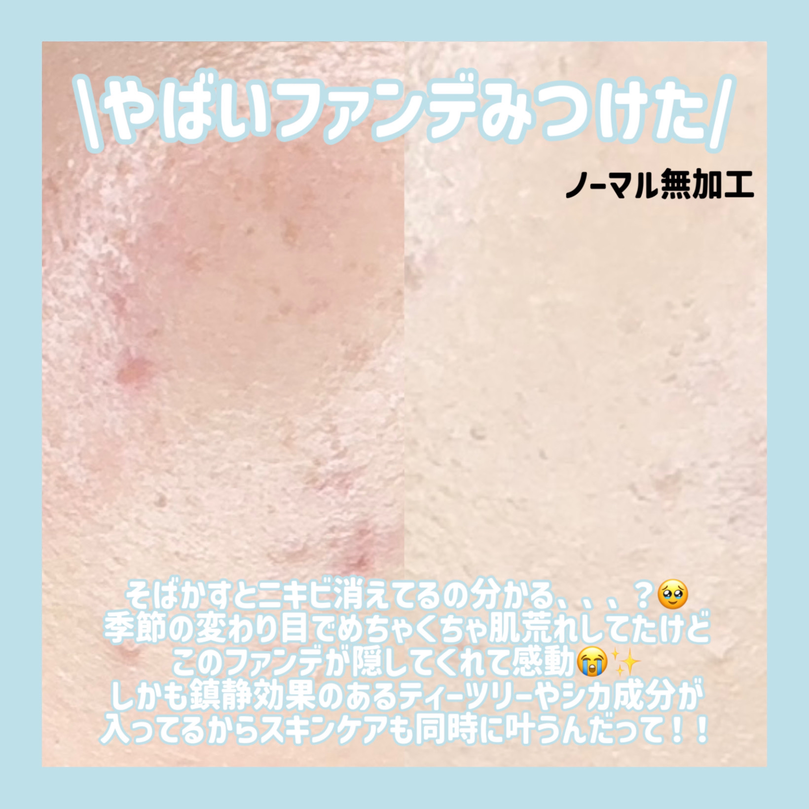 ピンクティーツリーカバーアップグロウクッション 17号 フローラルベージュ/APLIN/クッションファンデーションを使ったクチコミ（2枚目）