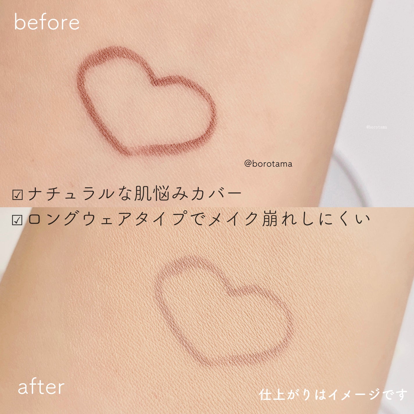 ダーマシンコンシーラー/23years old/リキッドコンシーラーを使ったクチコミ(8枚目)