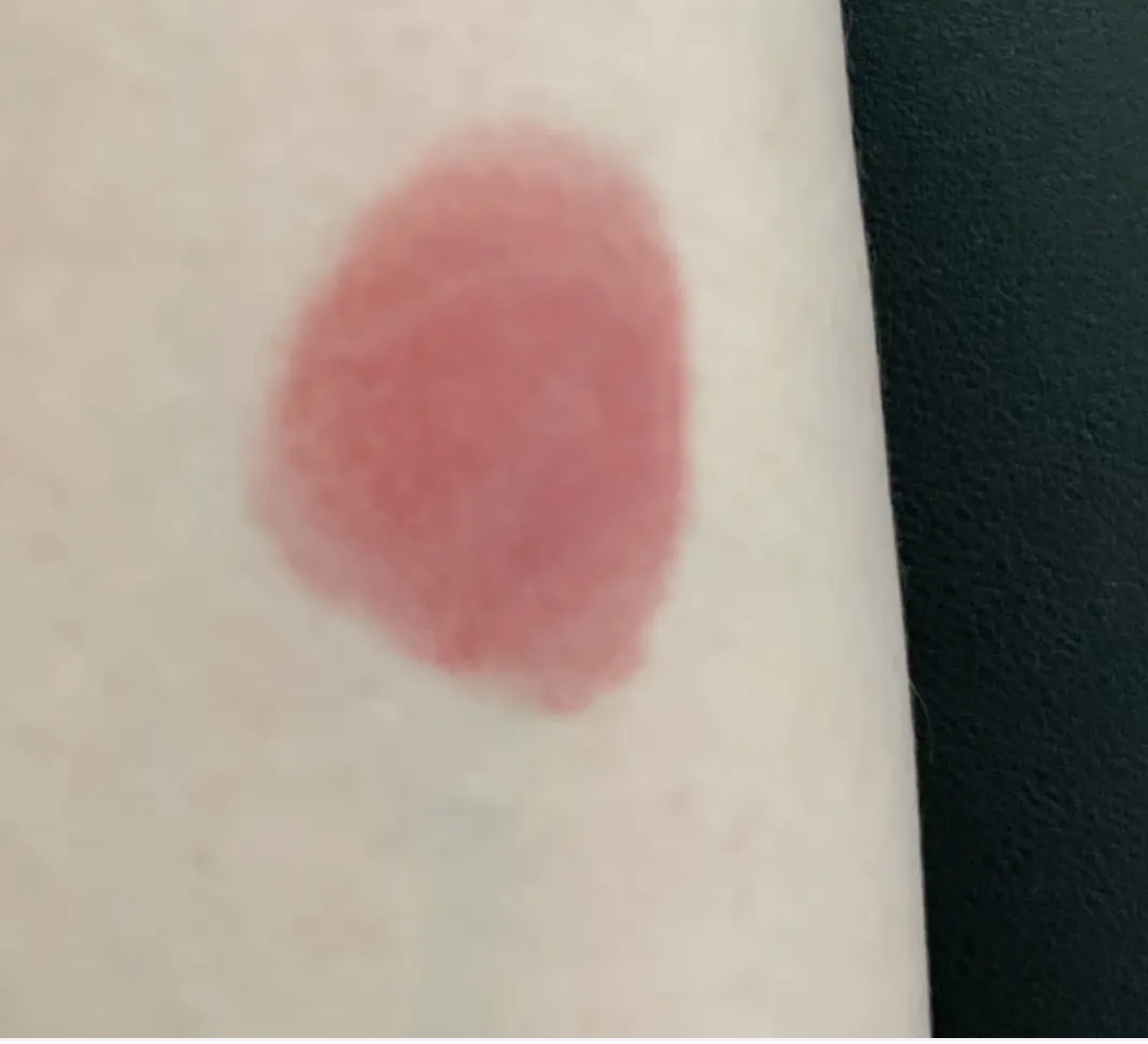 ディオール アディクト リップスティック 566 ピオニー ピンク（生産終了）/Dior/口紅を使ったクチコミ（2枚目）