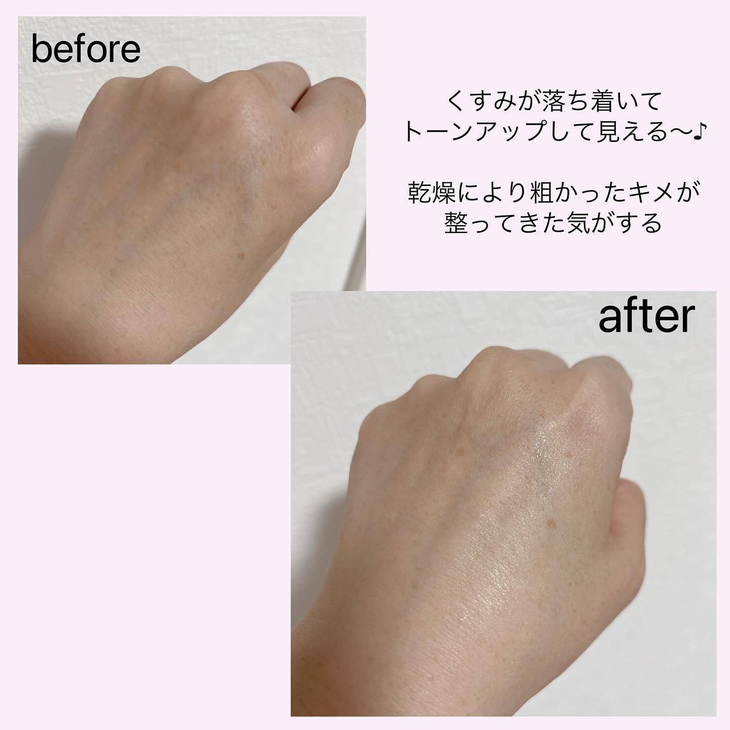 ロベクチン シカケア クリアリングアンプルのクチコミ「＼インナードライさん必見！毛穴レスセット／

・アクアヒアルロニックエッセンス

保湿を助けて.....」（3枚目）