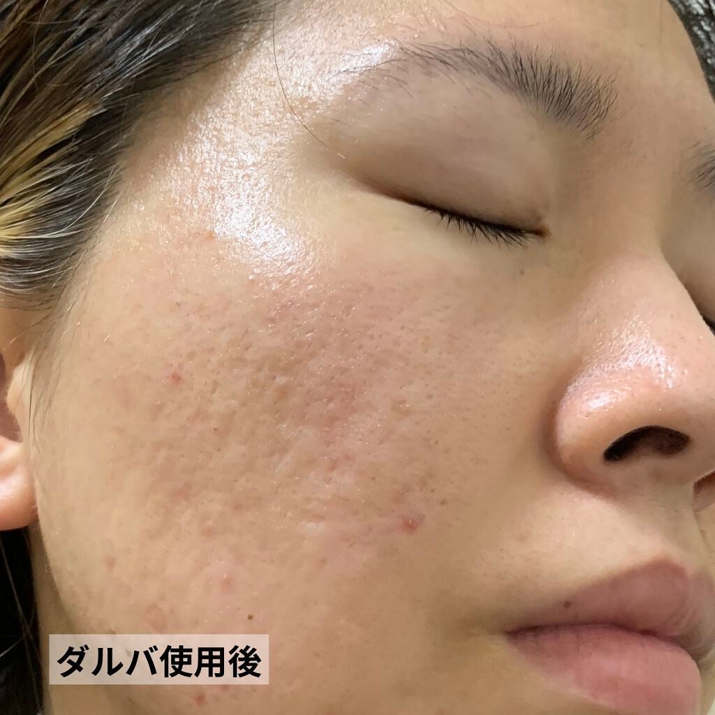 ダルバ ホワイトトリュフファーストスプレーセラム/ダルバ/ミスト状化粧水を使ったクチコミ(7枚目)