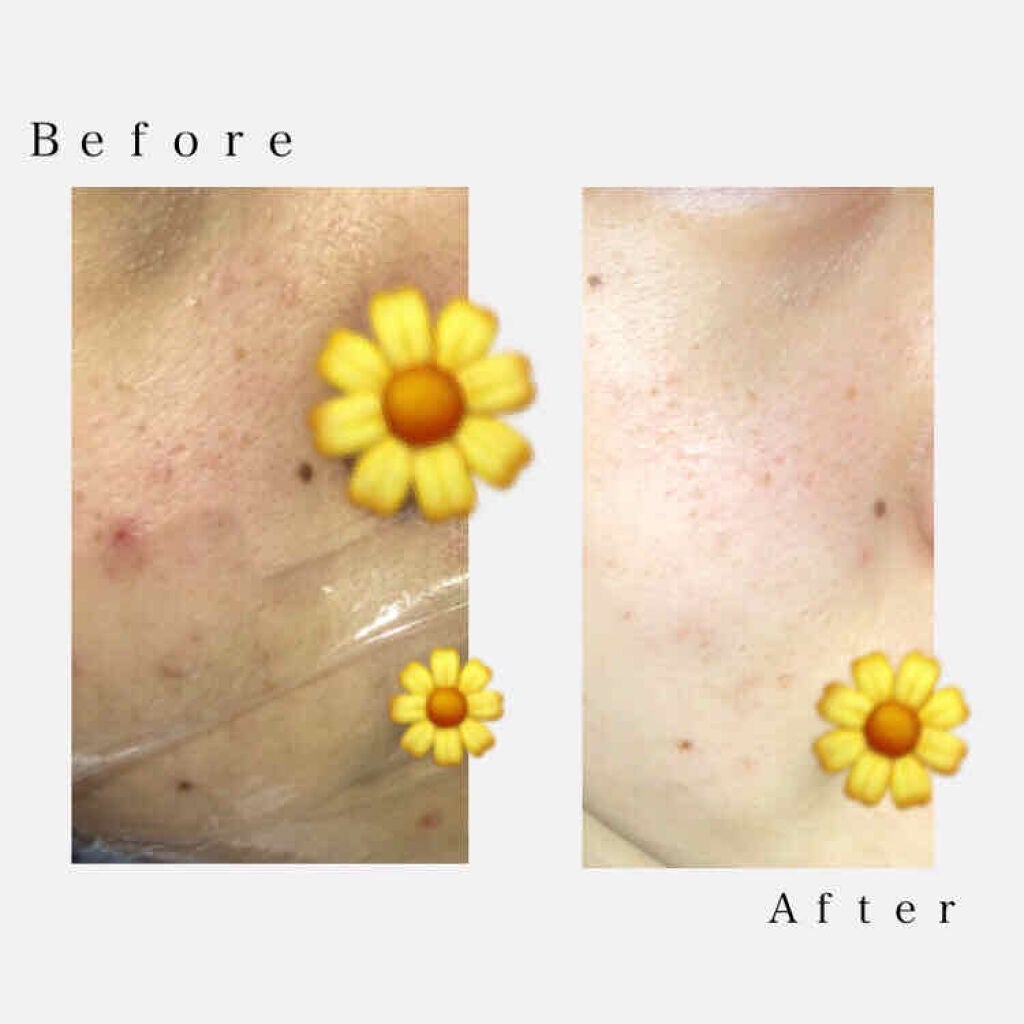 メイクも落とせる洗顔料 つるすべ美肌/ビオレ/ミルククレンジングを使ったクチコミ(3枚目)