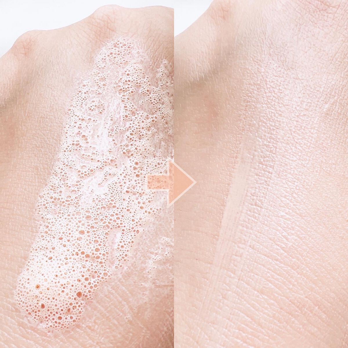 シンムース CCベース M/VIVISION/CCクリームを使ったクチコミ(3枚目)