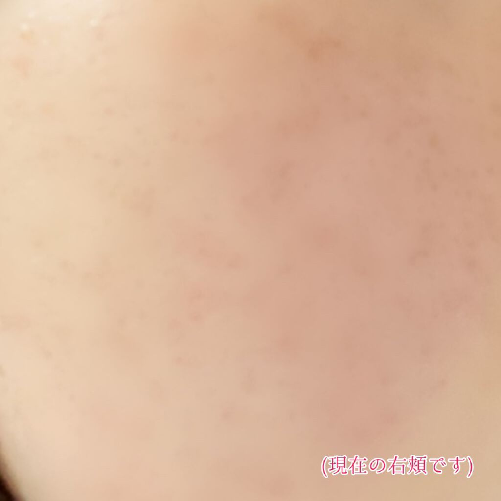 明色美顔水 薬用化粧水/美顔/化粧水を使ったクチコミ(4枚目)