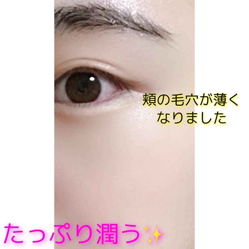 ガムシートマスクドクダミステッカー/Abib /シートマスク・パックを使ったクチコミ(6枚目)