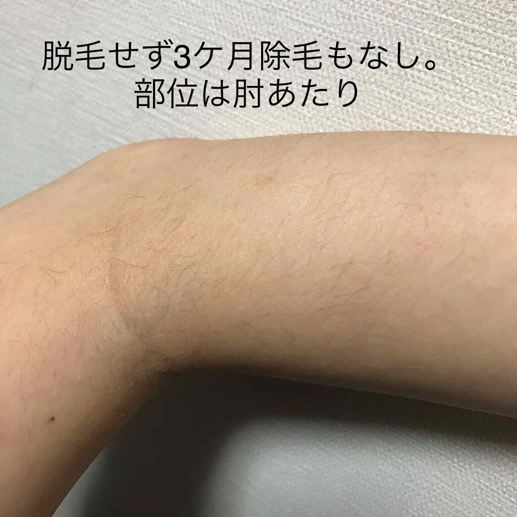 光美容器KE-NON(ケノン)/エムテック/家庭用脱毛器を使ったクチコミ(3枚目)