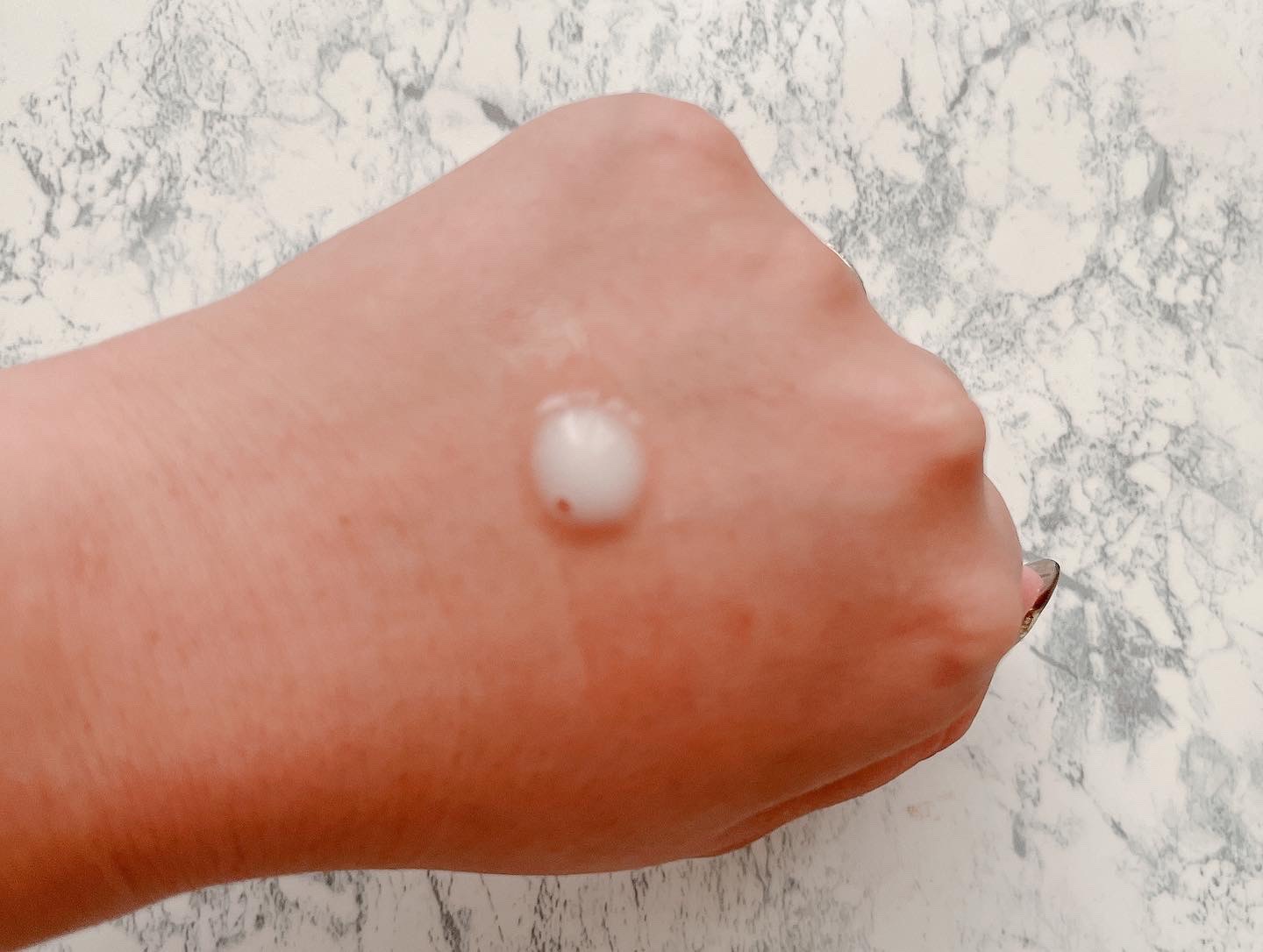 リードルショット300/VT/美容液を使ったクチコミ（2枚目）