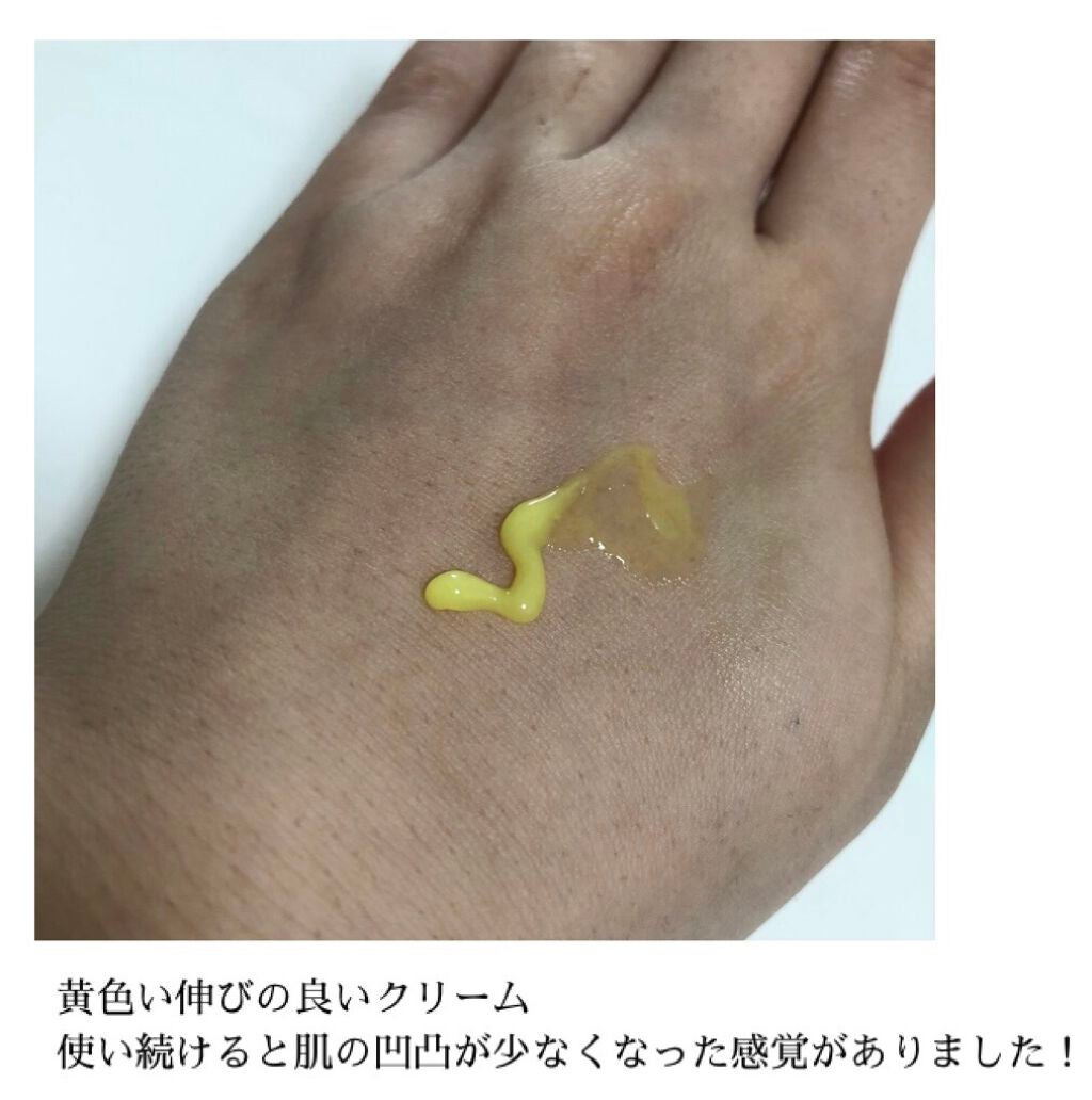 ビタアクナル TX ナイトクリーム/Dr.Different/フェイスクリームを使ったクチコミ(3枚目)