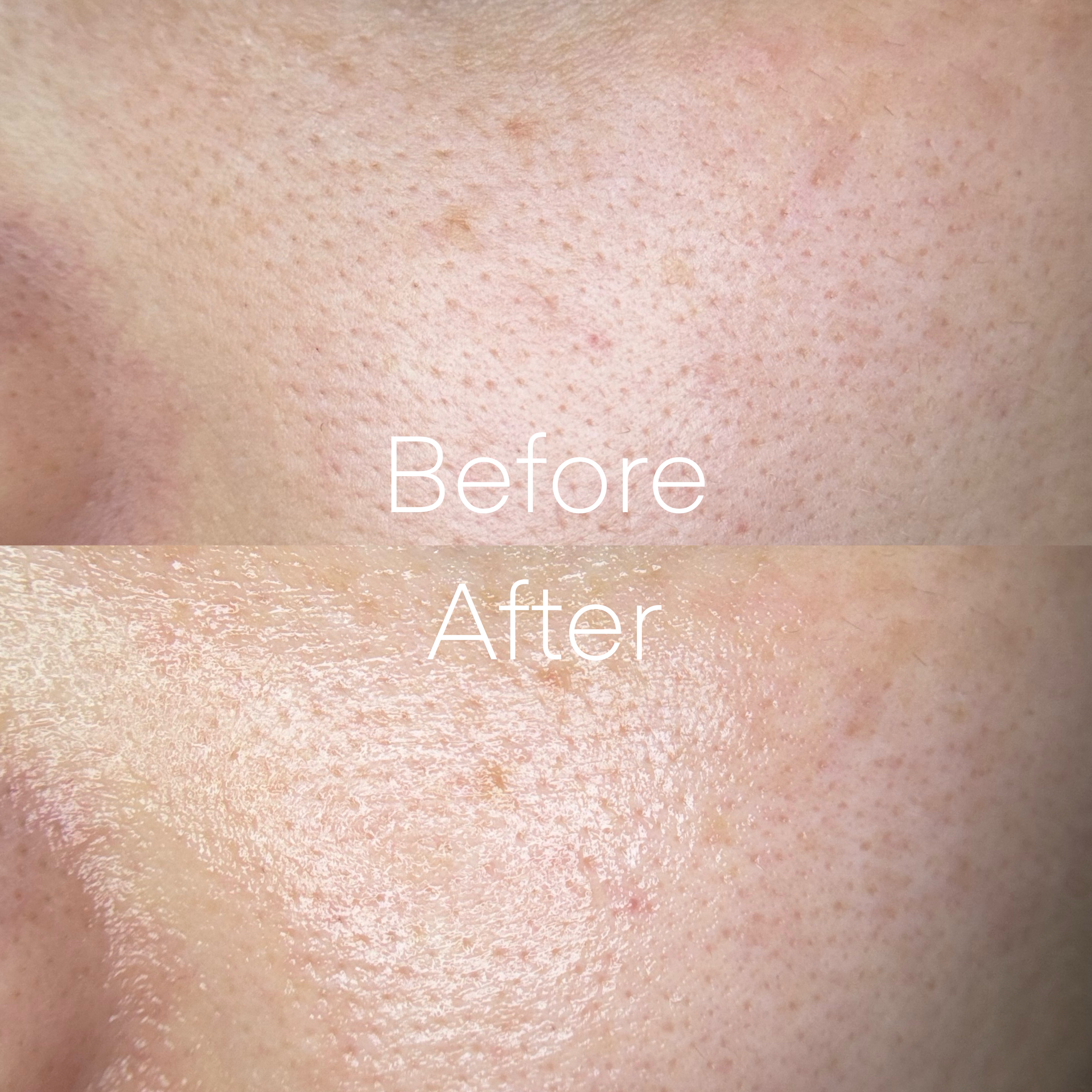 ゼロ毛穴パッド 2.0/MEDICUBE/トナーパッドを使ったクチコミ（2枚目）