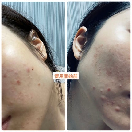 Cサスペンション23+HAスフィア2フェイスクリーム/The Ordinary/美容液を使ったクチコミ(3枚目)