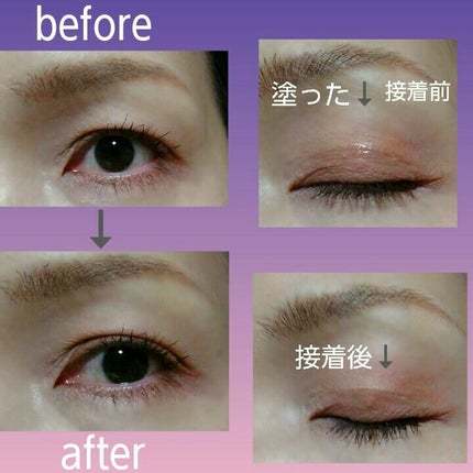 メザイク イージークリア 接着クリアタイプ/メザイク/二重まぶた用アイテムを使ったクチコミ(3枚目)