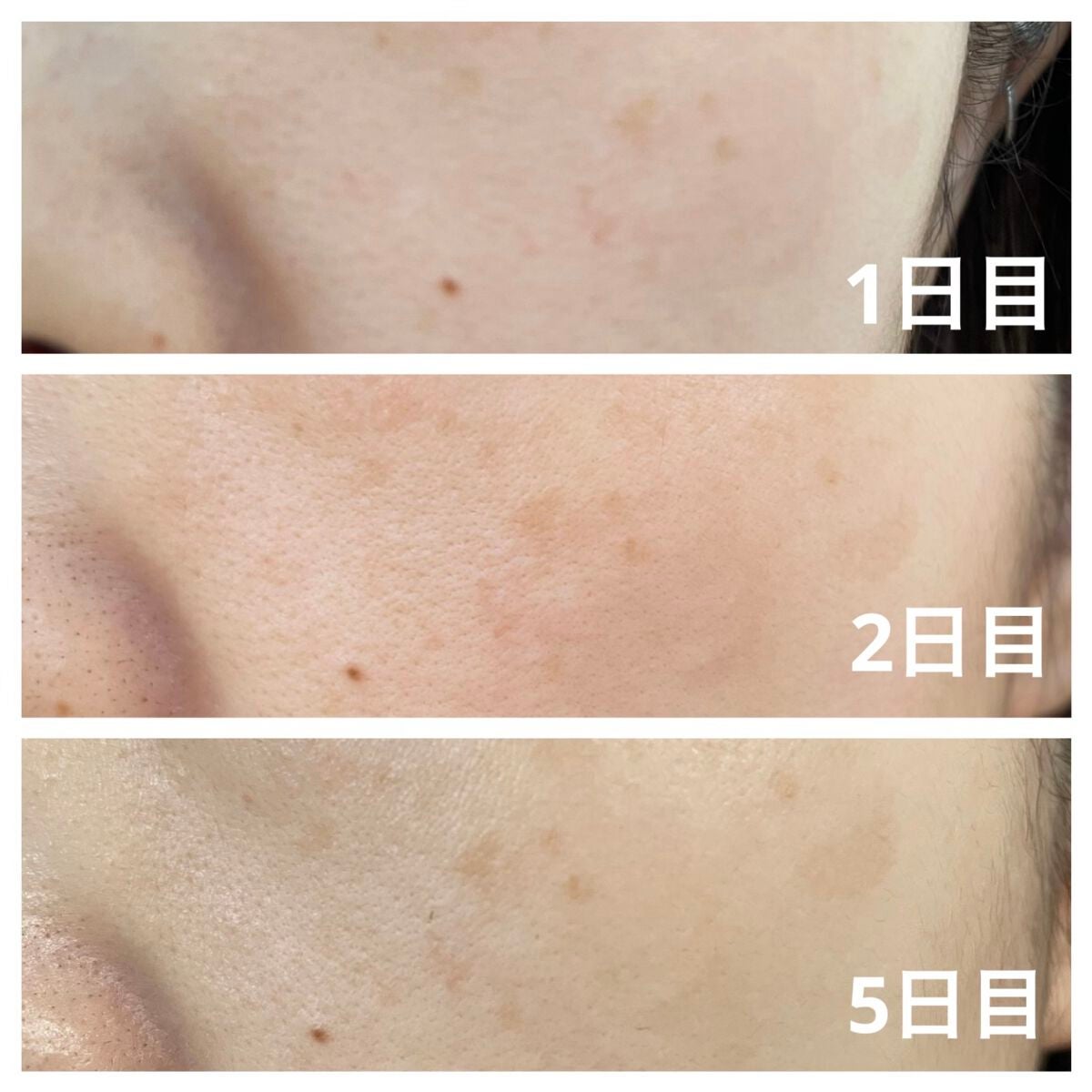 スーパーリンクルセラムVA/KISO/美容液を使ったクチコミ(2枚目)