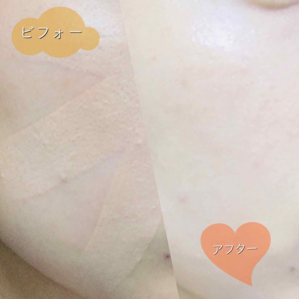 クリーミーファンデーションスティック/キャンメイク/その他ファンデーションを使ったクチコミ(3枚目)